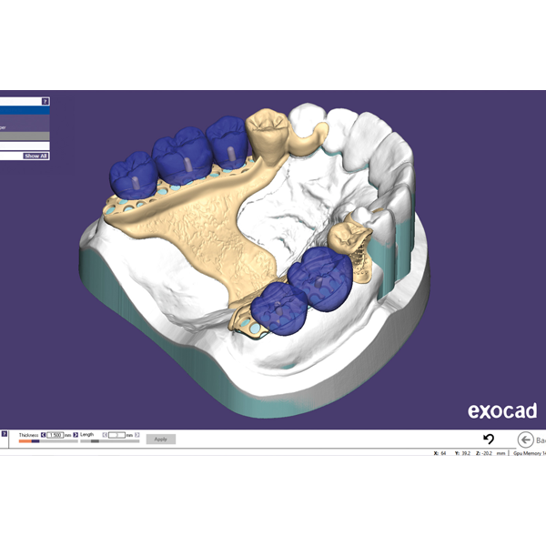 CAD/CAM